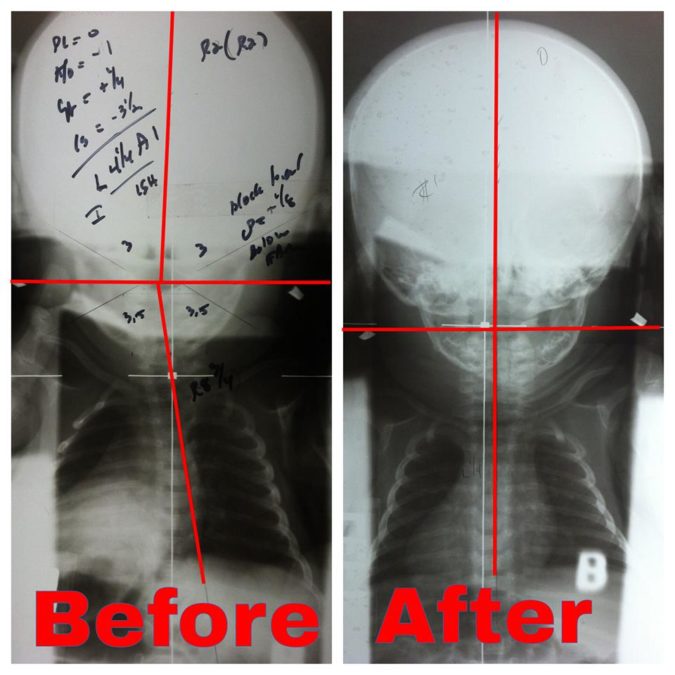 How We Are Different Atlas Spinal Care